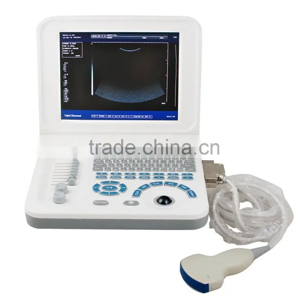 Carejoy Laptop Ultrasound Machine Ultrasound Scanner With Convex Probe RUS-9000F2 by CE ISO Approved photo-4