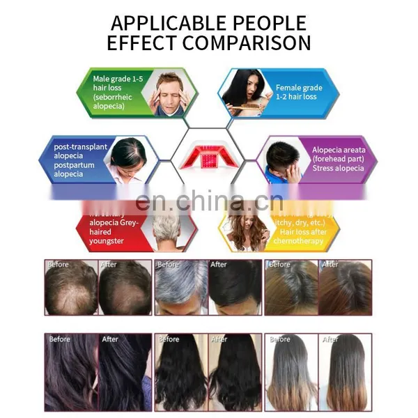 650nm Diode Laser SPA Scalp Treatment Machine With Hair Analysis Camera Professional Hair Regrowth Machine for Hair Salon photo-5