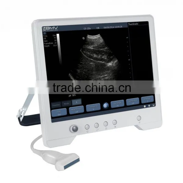 B&W Touch Screen Ultrasound Scanner/machine TS20 photo-2
