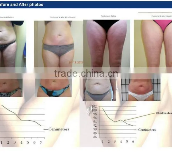 Latest Technology Slimming VelaSlim Body Shaping Machine photo-6