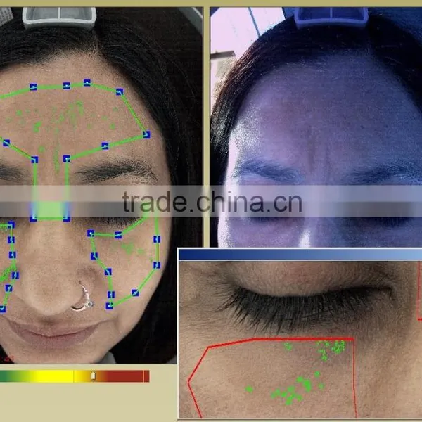Facial Checking Device/skin Analyzer Scope/portable Facial Skin Analyzer photo-5