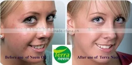 NEEM OIL IN BULK photo-5