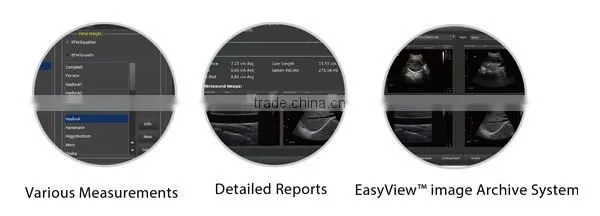 Hot Selling Portable Color Doppler Ultrasound Chison Eco5 Price photo-6