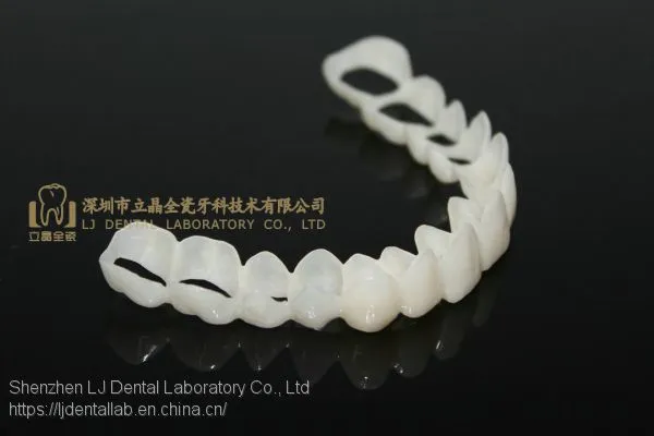 CAD/CAM PMMA Resin Clip on Veneers, Snap-on-veneers, Smile Veneers, Laboratoire Dentaire, Dentallabor, Laboratorio Dental, Dental Laboratory, Shenzhen LJ Dental Lab China photo-2