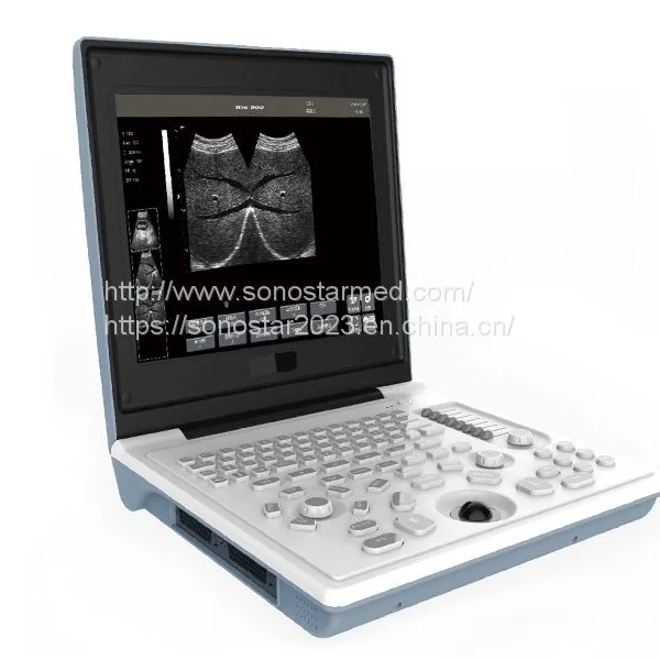 SS-6B Laptop All-Digital Ultrasound photo-4
