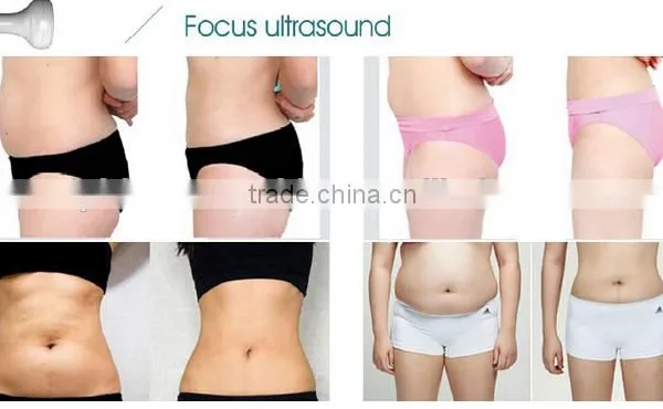 The Most Advanced Non Surgical Fat Reduction and Body Sculpting System Machine for Fat Loss photo-2
