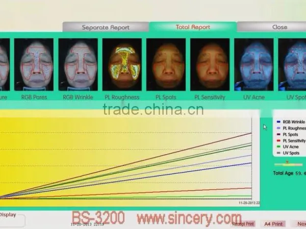 2014 Latest Magic Mirror System 3d Skin Analyzer photo-4