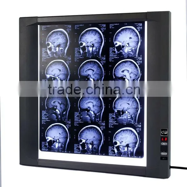 LED X-ray Film Viewer of Medical Equipment