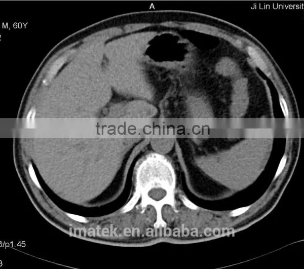 Inkjet Ink for Medical Image
