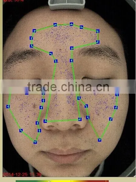 UV Light Skin Scope Face Skin Test Machine photo-5