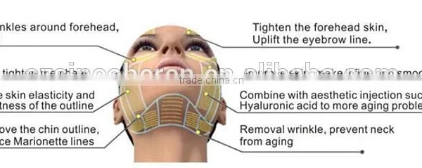 2016 Wrinkle Removal Slimming Portable Beauty Hifu photo-4