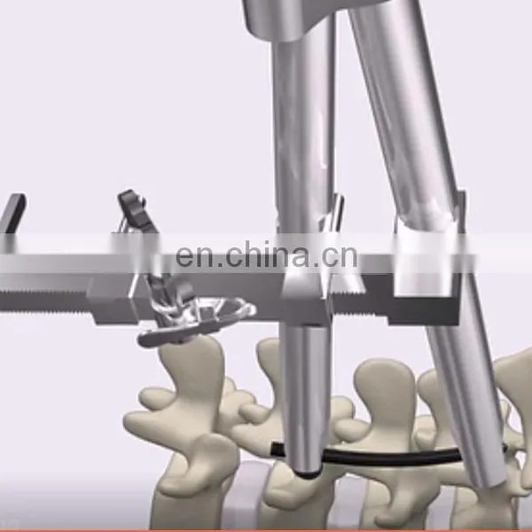 Spine Retractors, Neurosurgery Instruments, Spinal Surgery Distractor photo-6
