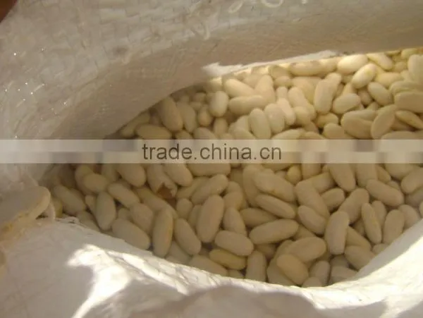 White Kidney Beans photo-2