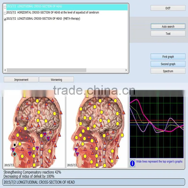 Meridian Digital Body Fat Analyzer 9D NLS Automotive Diagnostic Device photo-6
