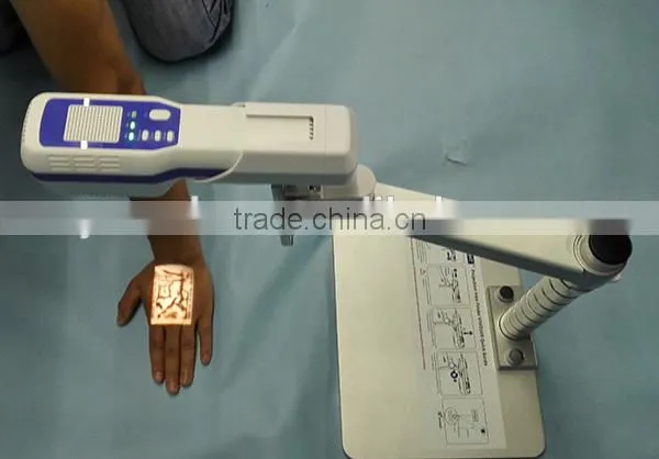 Good Price Easy Operate Medical Injection Portable Projection Vein Finder photo-5