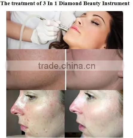 Face Skin Rejuvenation Oxygen Machine for Skin Care photo-6