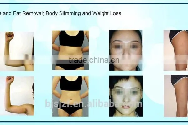 SL-3 Portable Lipo Laser Slimming Machine / Lipolysis Liposuction Fat Removal photo-3