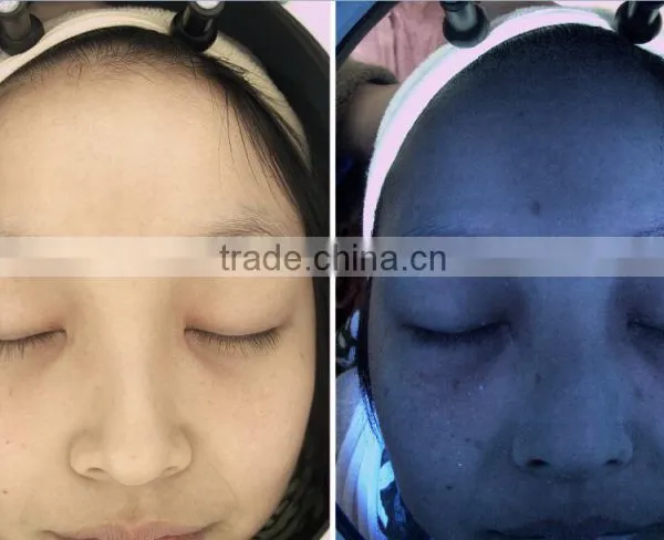 Langdy Facial Skin Analysis Machine Factory Direct Selling Price With CE photo-2