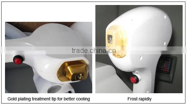 DL95 Portable Diode Laser Hair Removal Machine 808 Laser Diode 300w photo-2