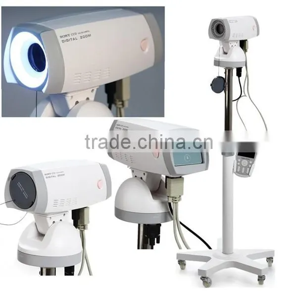 Professional Electronic Colposcope SONY Camera CCD 800,000 Pixels for Vulva Vagina Cervis photo-2