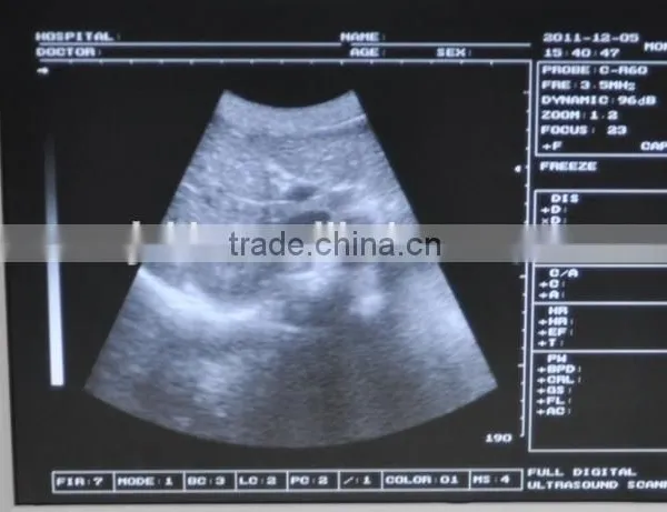 CE Approved Laptop/Portable Ultrasound Scanner With 3.5Mhz Multi-frequency Convex Probe photo-2