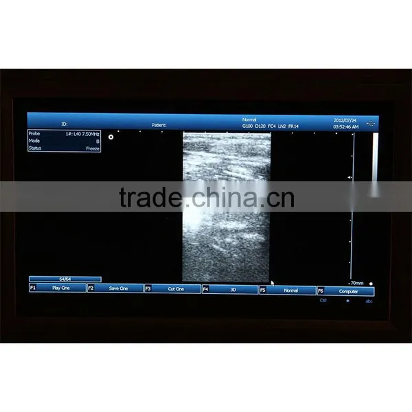 10.4 Inch LCD Laptop Ultrasound Machine PC System 3.5Mhz Convex Probe 7.5MHz Linear Probe Portable Ultrasound Scanner Price photo-5