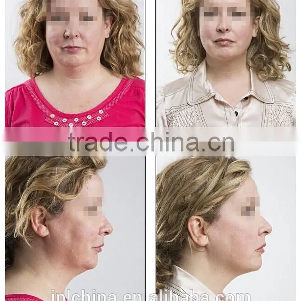 Portable PDT Skin Whitening Ultrasonic Facial Lifting Equipment - CE photo-6
