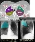Imaging Medical Ray Film,digital X-ray Cr,fuji X-ray Film Sale From Factory in Hanghzou