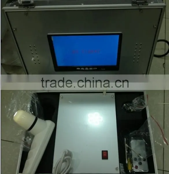 the Best Guangzhou 12inchLCD Freeze-frame Skin and Hair Analyser photo-2
