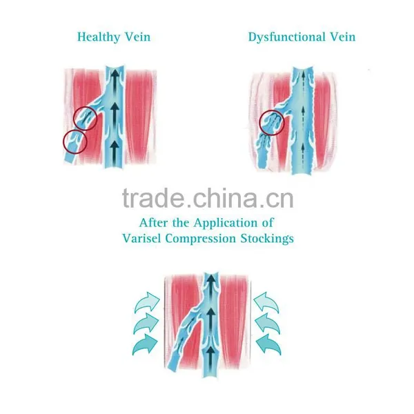 Anti-Embolism Stockings VAE-5 VAE-6 photo-4