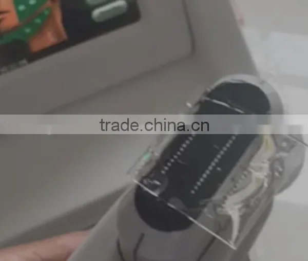High Intensity Focus Ultrasound HIFU for Face and Neck Lift Without Surgery photo-6