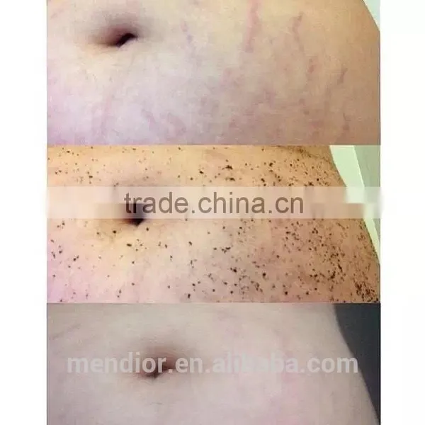 Mendior Organic Arabic Coffee Body Scrub Stretch Mark Eposon Salt OEM Body Polisher Scrub, SPA,custom Brand,200g photo-5