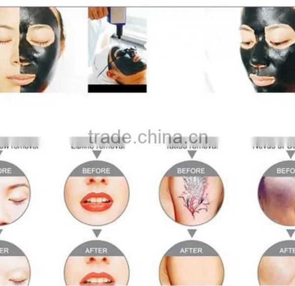 Nice Appearance AYJ-317 nd Yag Q Switch Laser Beauty Equipment photo-6