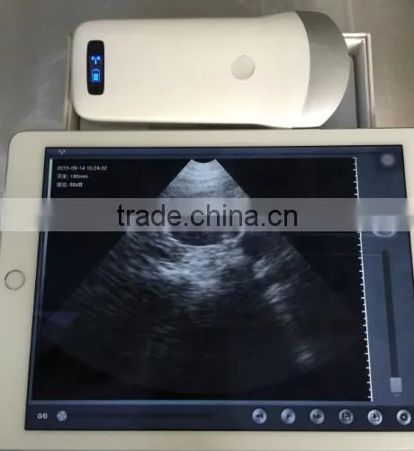 Excellent Portable Wireless Ultrasound Transducers for Sale -WBU01 photo-5
