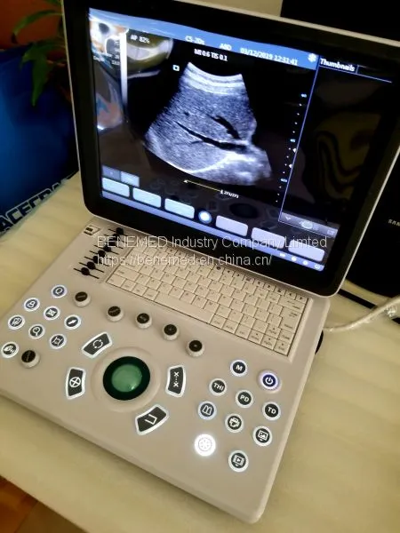 Ultraslim Notebook Type Black and White Ultrasound Scanner Equipment photo-2