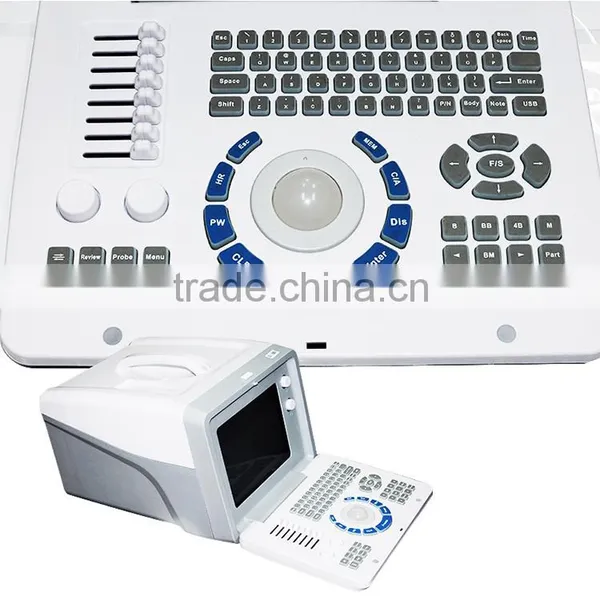 Medical Hospital Ultrasound Diagnostic Machine Portable Ultrasound Equipment photo-5