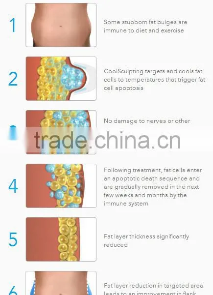 Cool Sculpting Cellulite Reduction !!!! 5 Handles Cryolipolysis Fat Freezing Slimming Best Cryolipolysis Machine Body Contouring photo-6