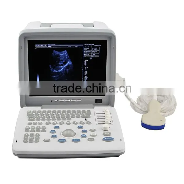 China Making 2016 High Performance Low Price Portable Mini Ultrasound Machine for Sale photo-3