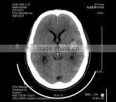 Imaging Medical Ray Film,digital X-ray Cr,agfa Dry Film Sale From Chinese Manufacturer