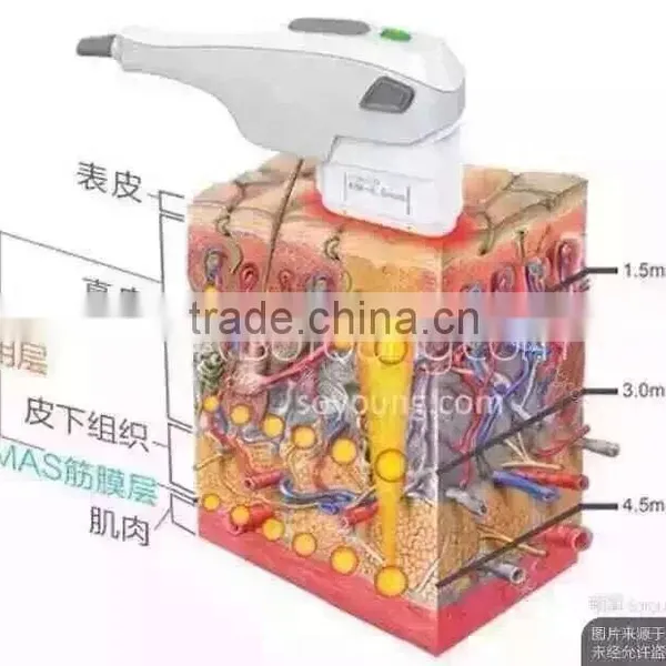 Promotion Equipped 3 Heads High Intensity Focuse Ultrasound Face Lifting Machine photo-2