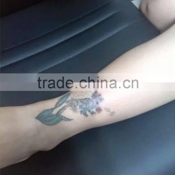 Sanhe With ce 1064 nm 532nm nd Yag Laser /medical Laser nd Yag Beauty Device on Hot Sale photo-6