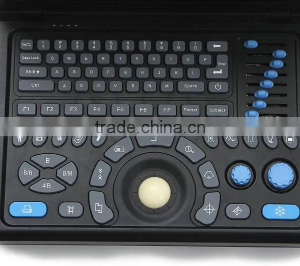 Hot Sale China Factory Medical Two Probe/transducer Connectors Portable Ultrasound Machine for Pregnancy photo-5