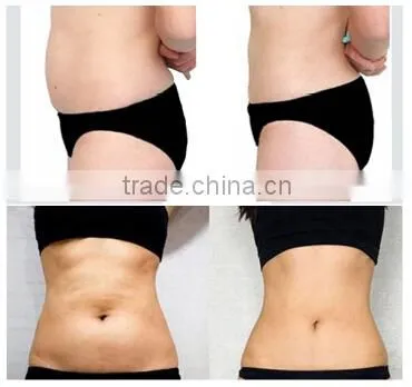 Deep Wrinkles Hifu Lose Skin Tightening Weight /hifu Machine/hifu With CE High Frequency Acne Machine photo-2