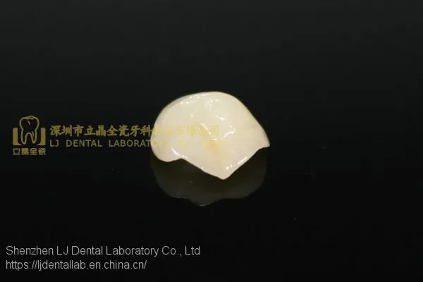 Dental Crown E.Max Ceramic, Porcelain Crown, Dental Veneers, Laboratoire Dentaire, Dentallabor, Laboratorio Dental, Dental Laboratory, Shenzhen LJ Dental Lab China photo-4
