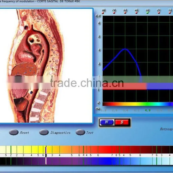 *2015*health Clubs Equipments,Money Maker Newest Health Analyzer photo-2