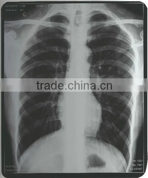 Agfa Hns Film, Agfa Film Dt2b of Medical Equipment Wholesale