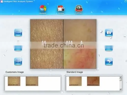 2014 New Designed Handheld Skin Analyze Camera photo-4