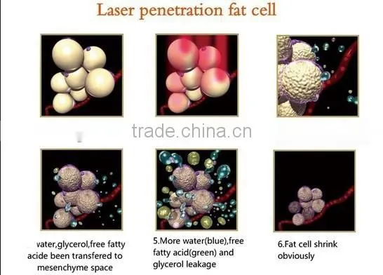 Medical CE ISO 13485 Machine/ Laser Slimming Machine for Fat Reducing photo-5