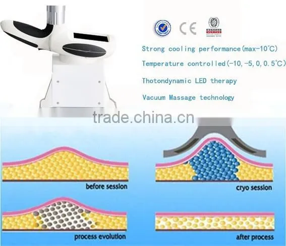 Fat Less Machine Advance Cryo Flabby Skin Freeze Cryolipolysis Cryo Lipolysis Machine Body Shaping photo-6