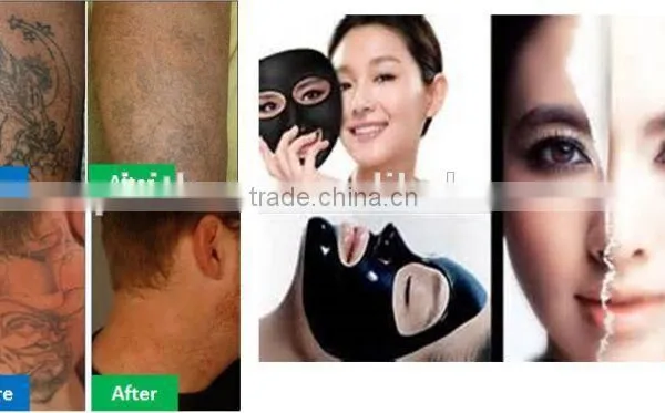 Good Portable Beauty Equipment Yag Laser Tattoo Removal Lasers photo-3